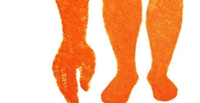 화이트 레인 앤드 레드 렉스